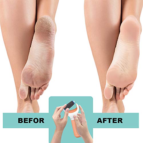 WXJ13 - Rodillos de repuesto para pedicura (12 unidades, 3 grados diferentes de rugosidad para rodillo de repuesto Scholl para pedicura