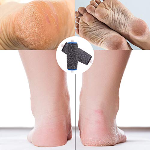 WXJ13 - Rodillos de repuesto para pedicura (12 unidades, 3 grados diferentes de rugosidad para rodillo de repuesto Scholl para pedicura