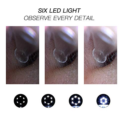 XGLL Endoscopio de Limpieza oídos WiFi, otoscopio Digital oído de 1.0MP HD con 6 Luces LED para iPhone Android, iPad, iOS,Blue