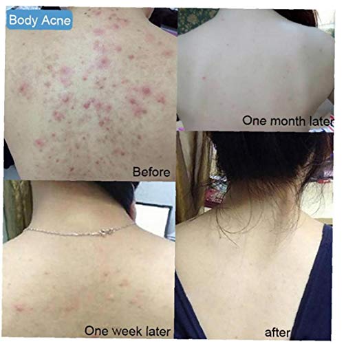 XKJFZ Sal Jabón Hecho a Mano 1pc Mar Orgánica De Leche De Cabra Jabón Exfoliante E Hidratante De La Piel Enfermedades De La Piel De Limpieza Profunda Jabón Natural para Todos