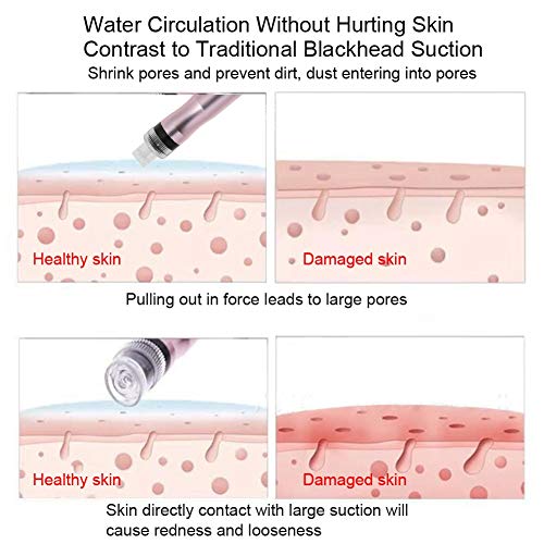 yeyat Dispositivo antienvejecimiento, pequeñas Burbujas, succión al vacío, Equipo de Belleza, Facial Interna, espinilla, rejuvenecimiento de la Piel Limpia(EU)