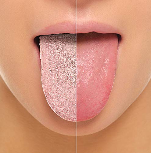 YogaMedic Limpiador de Lengua de cobre [2x] - 100% cobre, naturalmente Anti-Microbiano para combatir el mal aliento - Raspador de lengua - tongue scraper