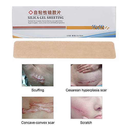 YOUTHINK Hojas de Eliminación de Cicatrices de Silicona para Cicatrices Causadas por Cesárea, Cirugía, Quemaduras, Queloides, Acné y Más, Hechas de Material de Silicona Suave de Grado Médico(1)