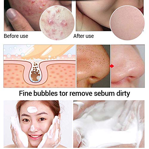 YSoutstripdu Jabón, Aceite de árbol de té Hecho a Mano jabón Limpiador Facial acné Tratamiento de la Piel Blackhead Cuidado-Verde