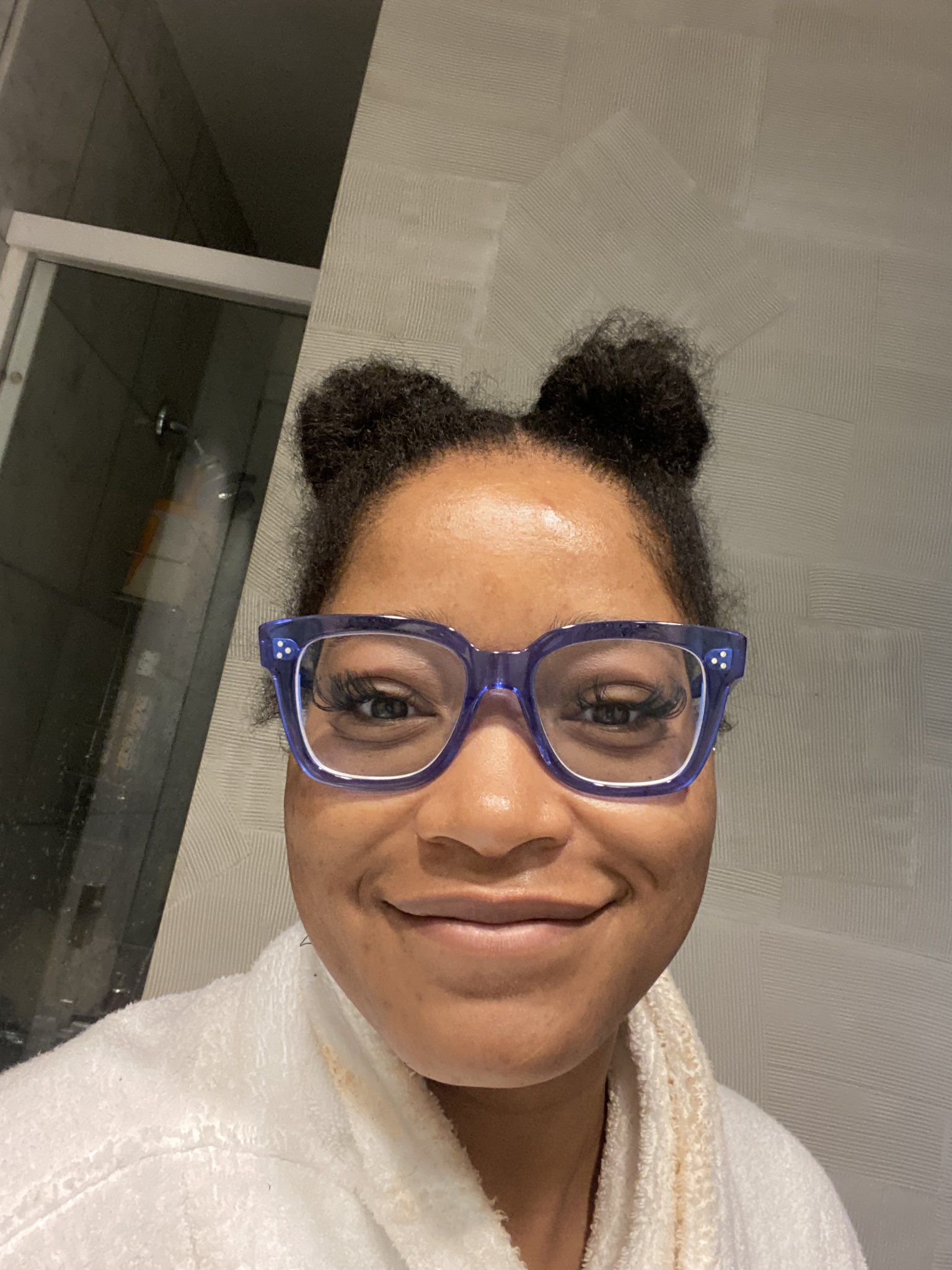 Keke Palmer acaba de compartir una foto sin maquillaje y se abrió sobre las luchas de acné pasadas