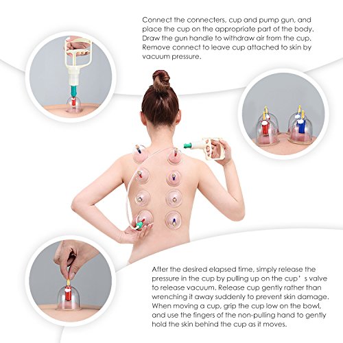 12x ventosas ,Set Ventosa Cupping Terapia Chinas por ZHOUZEKAI@, Medicina Curacion Tratamiento Caseras para Celulitis, Dolor de Espalda, Facial,Adelgazar, Pies,Estomago,Bajar de Peso