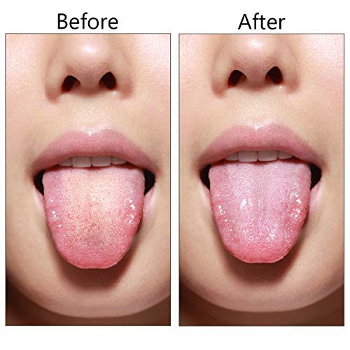 2 piezas Limpiadores de Lengua de Acero, Inoxidable Raspador de Lengua Previene la Halitosis, Ayurvédico Cepillo de Lengua Promoción de la Salud Bucal - con Bolsas de Cordón Impermeables