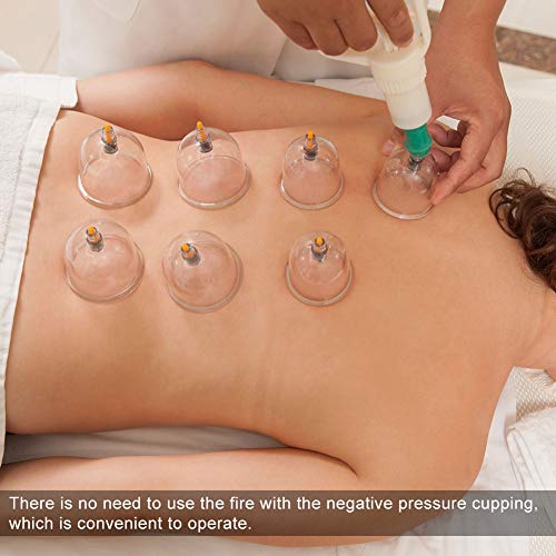 24 piezas de ventosas profesionales Equipo de Equipmentm, Tazas en forma de U Juego de ventosas al vacío chino con mango de bombeo, Terapia de masaje de espalda Acupuntura de succión al vacío