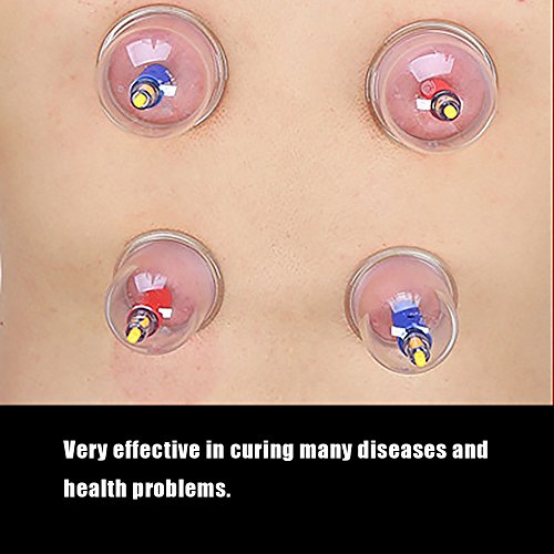 24 piezas de ventosas profesionales Equipo de Equipmentm, Tazas en forma de U Juego de ventosas al vacío chino con mango de bombeo, Terapia de masaje de espalda Acupuntura de succión al vacío