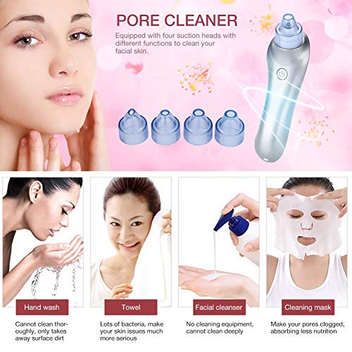 4 Cabezas reemplazables vacío del retiro de la espinilla, Dispositivo ultrasónico Pelar, Limpiador de poros acné succión Limpiador Facial del Cuidado (F1) kshu (Color : F2)
