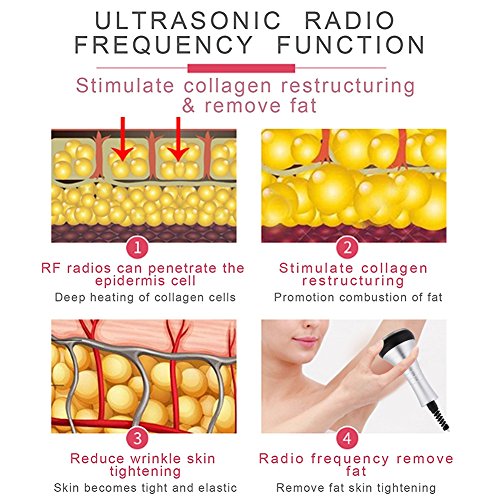 5 en 1 Ultrasonidos Celulitis Grasa RF bipolar de radiofrecuencia máquina con 40 k Masaje de vacío por cavitación ultrasónica para Celulitis Grasa(EU)