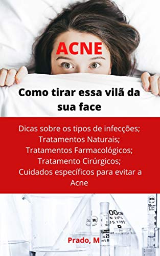 ACNE: Tire essa Vilã da sua Face (Portuguese Edition)