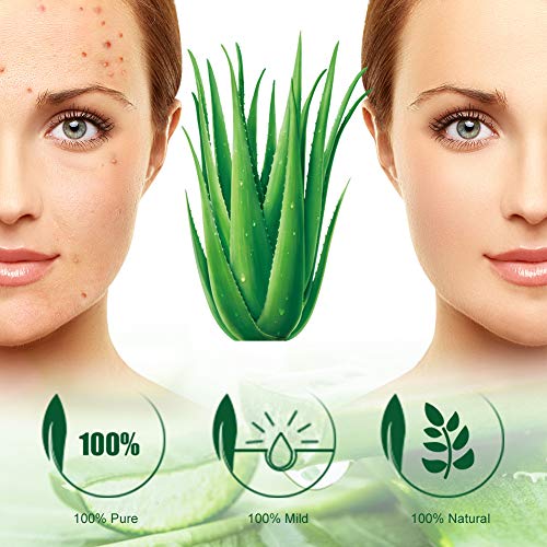 Acne Tratamiento,Tratamiento Acné gel,Crema Antiacne,Reducir los Puntos negros, Equilibrar el Agua y el Aceite, la Crema Contra el Acné Espinilla Regenera la piel