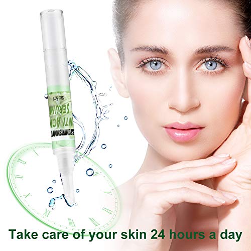 Acne Tratamiento,Tratamiento Acné gel,Crema Antiacne,Reducir los Puntos negros, Equilibrar el Agua y el Aceite, la Crema Contra el Acné Espinilla Regenera la piel