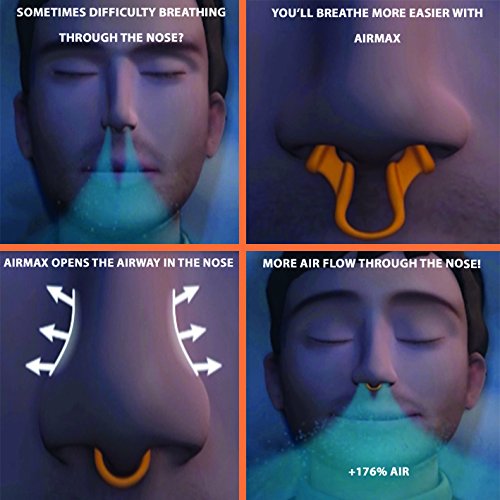 Airmax - Dilatador nasal eficaz para los ronquidos y la congestión nasal - 1x de tamaño mediano - Dispositivo médico recomendado por los médicos …