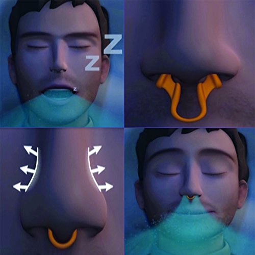 Airmax - Dilatador nasal eficaz para los ronquidos y la congestión nasal - 2x de tamaño mediano - Dispositivo médico recomendado por los médicos