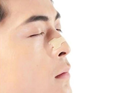 AirPromise 100 PCS Mejor Respira Las Tiras NASALES para Reducir LA PATOLOGÍA RESPIRATORIA DE Snore para Dormir Mejor Tomar MÁS Aire | Mejora del Rendimiento Deportivo (66 * 19 MM, 100 PCS)
