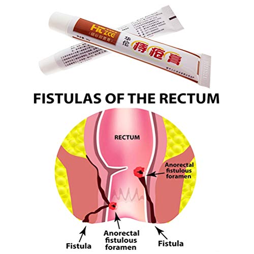 Akemaio 25g Hua Tuo hemorroides pomada para Las hemorroides internas, Natural de la Planta a Base de Plantas de Gran Alcance hemorroides Crema