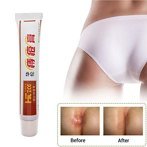 Akemaio 25g Hua Tuo hemorroides pomada para Las hemorroides internas, Natural de la Planta a Base de Plantas de Gran Alcance hemorroides Crema