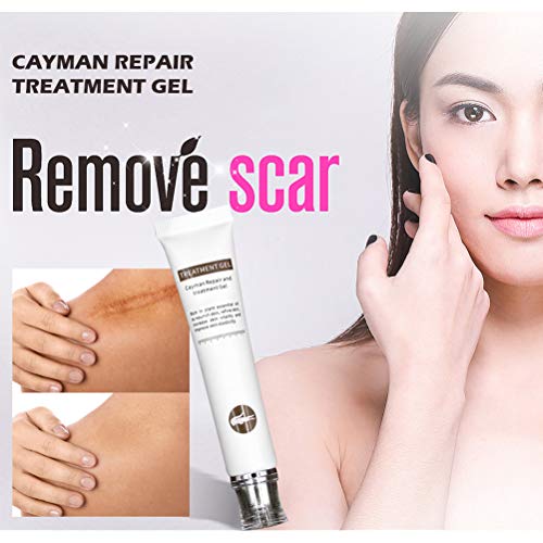 Anewu Crema para Cicatrices, Crema para Cicatrices Crema para estrías Crema eficaz para Eliminar Cicatrices de acné y Cicatrices Crema para estrías para Cara o Cuerpo