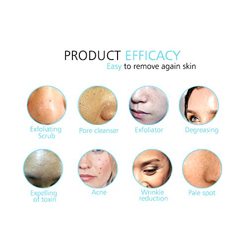 Anself - Limpiador ultrasónico facial para espinillas puntos negros,depurador masajeador facial para mejorar piel poros
