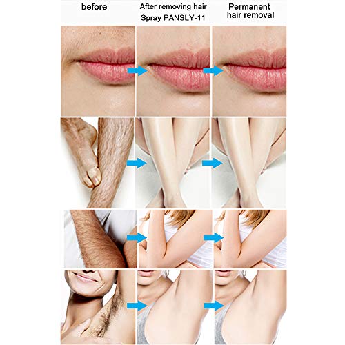 Anself PANSLY 20ml Inhibidor de Vello Depilación Permanente Piernas Axila Barba Blanda Stop Spray sin dolor