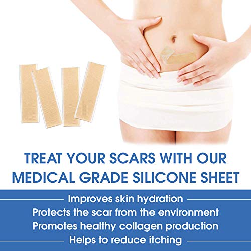 Antitranspirante roll-on Perspirex Comfort, 20 ml, paquete de 3