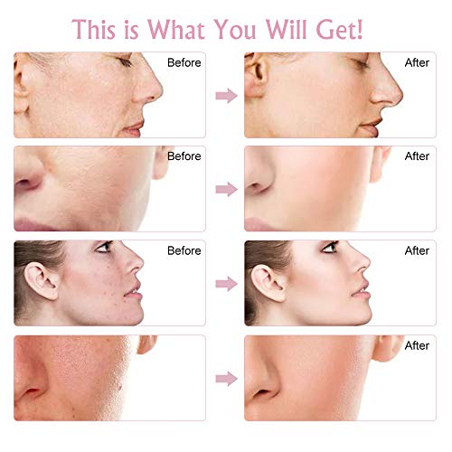 Aparato Facial, Facial Aparato Radiofrecuencia Massager beauty Machine Removedor de acné Antiarrugas/Envejecimiento, ION Photon Cuidado de la piel cosmético 5 en 1