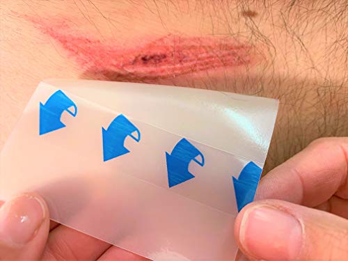 Apósito de herida estéril, hidrocoloides, extrafino, 10 x 10 x 5 cm