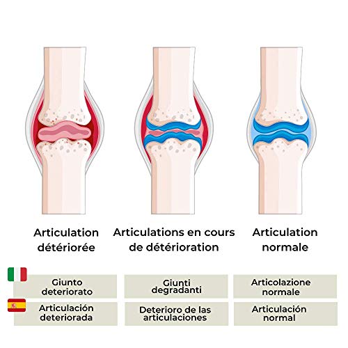 ARTICULACIONES. Dolor y movilidad articular| 2 patentes naturales superiores a la glucosamina según estudios| cúrcuma jengibre fenogreco orgánica (polisacáridos & curcumina)