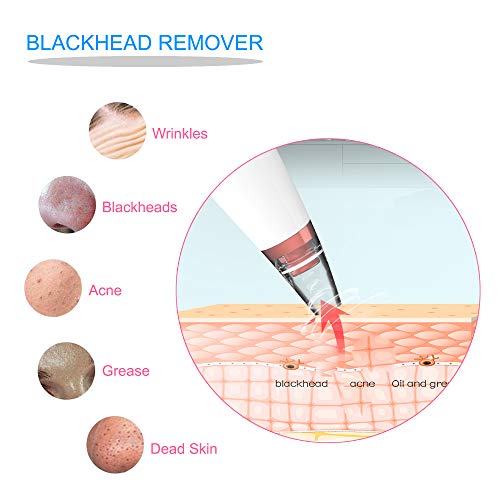 Aspiradora de poros con removedor de espinillas, limpiador poros Extracción de comedones faciales y el limpiador facial succión de poros eléctrico, limpia las narices de mujeres y hombres
