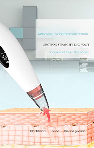 Aspiradora de poros con removedor de espinillas, limpiador poros Extracción de comedones faciales y el limpiador facial succión de poros eléctrico, limpia las narices de mujeres y hombres