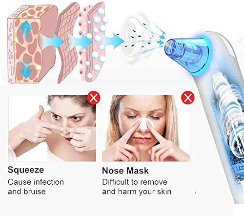 Aspiradora para Eliminar Espinillas de Prechkle - Dispositivo Eléctrico de Eliminación de Comedones, Herramienta para Espinillas Recargable USB con 6 Cabezales de Succión y Pantalla LED