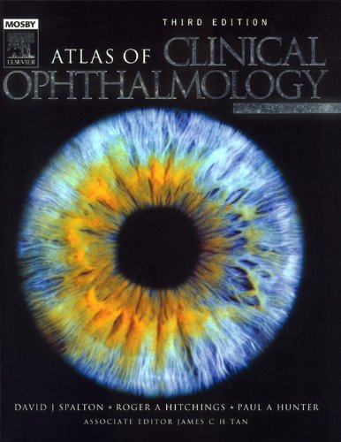 Atlas of Clinical Ophthalmology (English Edition)
