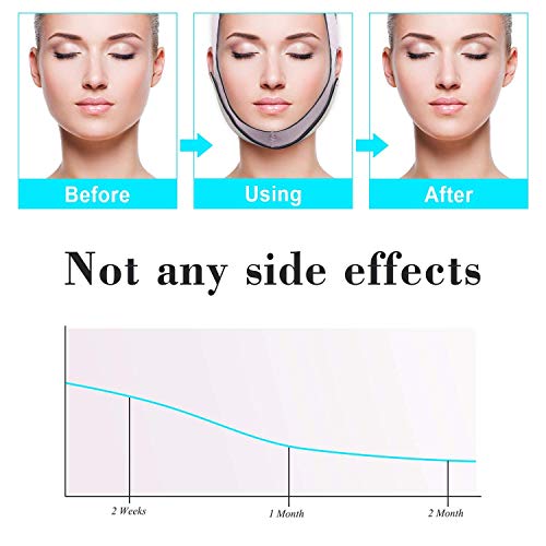 Banda moldeadora de cara sin dolor, vendaje de estiramiento facial de línea en V, cinturón de pérdida de peso facial reductor de doble mentón, elimina la flacidez de la piel reafirmante de estiramie