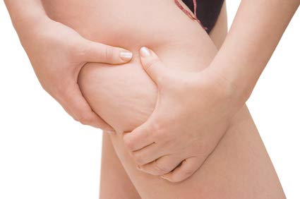 BINGOSPA Algas contra la celulitis, estrías para envolturas y masajes - 250g