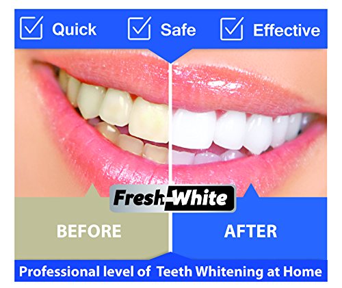 Blanqueamiento de dientes tiras con avanzada tecnología antideslizante - 28 Whitening Strips