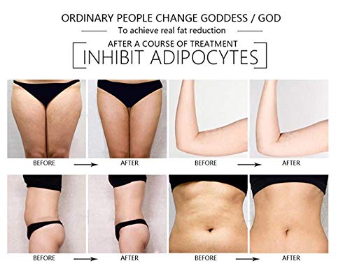 BLH-JMJ Máquina de Adelgazamiento Corporal, Grasa Eliminar el masajeador de Cintura Instrumento de pérdida de Peso Equipo de Belleza Antiarrugas