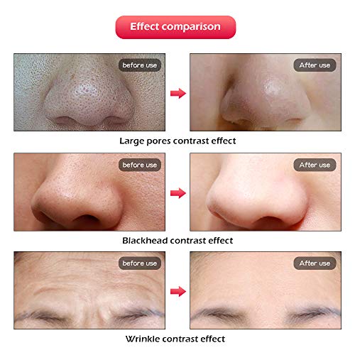 BLH-JMJ Tratamiento de luz con máscara LED de 7 Colores, Cuidado Facial reafirmante de colágeno Máscara LED Antiarrugas y Anti-acné con Cuello Adecuado para el hogar