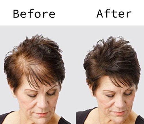 BLISSANY Fibras capilares - Engrosamiento del cabello - Cabello desparramado - Polvo capilar - Fibras capilares para hombres y mujeres - Pelo grueso inmediatamente atrás, 28g (marrón)