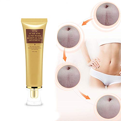 Bonbela 30g de la Piel Facial Cicatriz del acné Marcos eliminación de geles de Cuerpo Ungüento acné Post-Parto Eliminación de Cicatrices Cuidado de la Piel Crema de la Cicatriz del acné