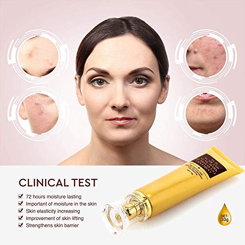 Bonbela 30g de la Piel Facial Cicatriz del acné Marcos eliminación de geles de Cuerpo Ungüento acné Post-Parto Eliminación de Cicatrices Cuidado de la Piel Crema de la Cicatriz del acné