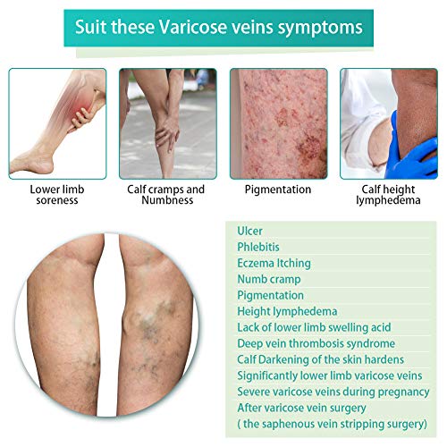 Calcetines de Compresión con Cremallera, Calcetines de Soporte para Piernas con Cremallera Abierta de 15-20 mmHg, Calcetines Médicos Transpirables para Aliviar la Hinchazón y las Venas Varicosas