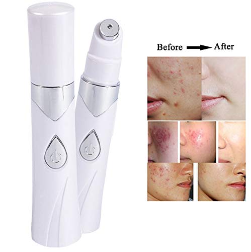 Carga acné azul potente antrenosa varices eliminación de acné pluma terapia de luz azul tratamiento equipo de belleza electrónica