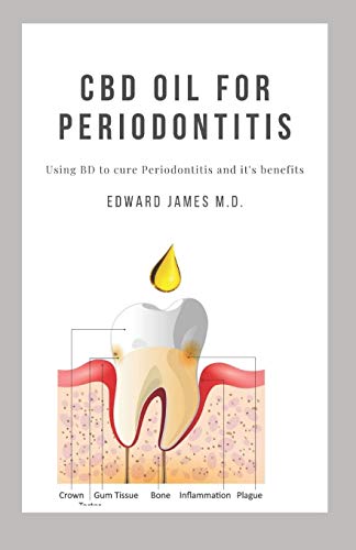 CBD OIL FOR PERIODONTITIS: USING CBD TO CURE PERIODONTITIS AND IT'S BENEFITS