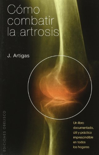Cómo combatir la artrosis (SALUD Y VIDA NATURAL)