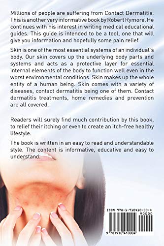 Contact Dermatitis. Contact Dermatitis Treatments, Home Remedies and Prevention. Understanding Contact Dermatitis as a Disease and Finding Cure for It