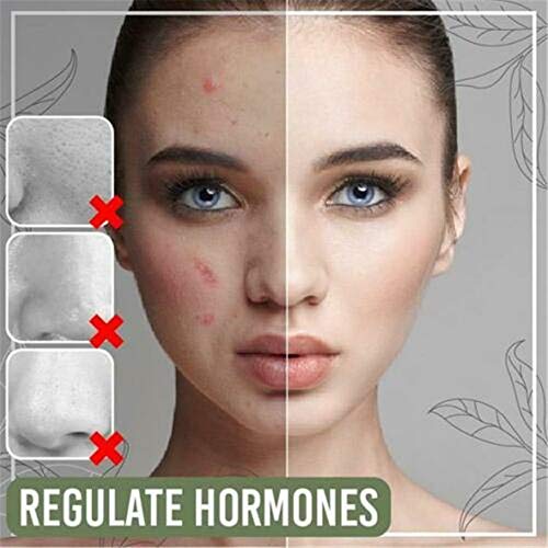 Crazy Ling Mascarilla De Lodo Limpiador Refrescante De Té Verde, Mascarilla Facial De Té Verde Matcha, Mascarilla Limpiadora De Té Verde, Mascarilla Limpiadora Facial, Minimizador De Poros