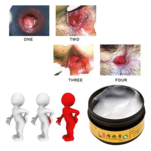 Crema Anal para hemorroides Natrual Crema Anal para hemorroides internas Pilas Fisura Anal Externa