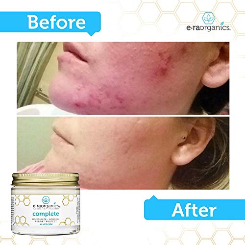 Crema Hidratante Natural para la Piel 60ml Curación Avanzada 10-en-1 Fórmula no grasosa con Aloe Vera Orgánico, Miel de Manuka, Aceite de Coco y Más. La mejor crema facial para la piel grasa, seca, d